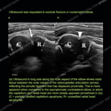Image - Ultrasound Case 129 thumbnail