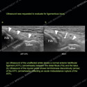 Image - Ultrasound Case 130 thumbnail