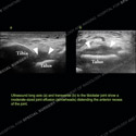 Image - Ultrasound Case 132 thumbnail