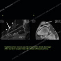 Image - Ultrasound Case 133 thumbnail