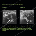 Image - Ultrasound Case 135 thumbnail