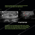 Image - Ultrasound Case 137 thumbnail