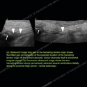 Image - Ultrasound Case 138 thumbnail