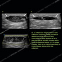 Image - Ultrasound Case 141 thumbnail