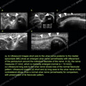 Image - Ultrasound Case 142 thumbnail