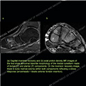 Image - Ultrasound Case 143 thumbnail