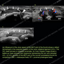 Image - Ultrasound Case 145 thumbnail