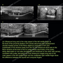 Image - Ultrasound Case 146 thumbnail