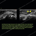 Image - Ultrasound Case 148 thumbnail