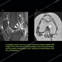 Image - Ultrasound Case 149 thumbnail