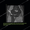 Image - Ultrasound Case 150 thumbnail