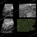 Image - Ultrasound Case 152 thumbnail