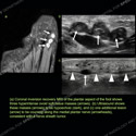 Image - Ultrasound Case 153 thumbnail