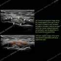 Ultrasound case 159 thumbnail