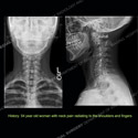Image - What's the Diagnosis Case 152 thumbnail