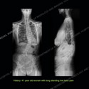 Image - What's the Diagnosis Case 153 thumbnail