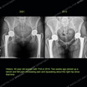 Image - What's the Diagnosis Case 160 thumbnail