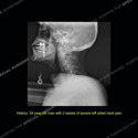 Image - What's the Diagnosis Case 174 thumbnail