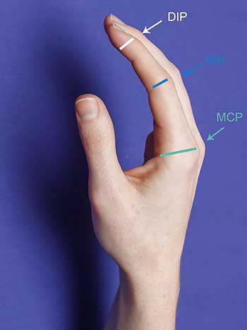 Photo of left hand side view, thumb side up notating DIP, PIP and MCP