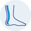 Ankle Replacement (Ankle Arthroplasty)