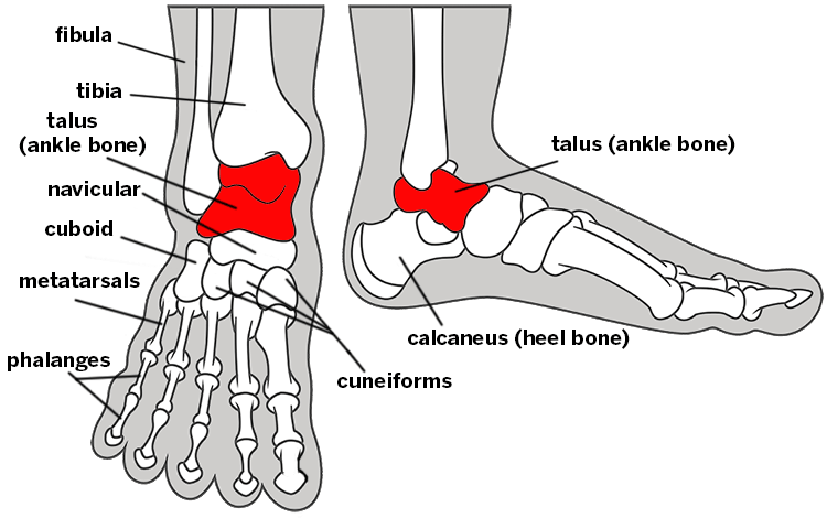 Osteochondral Lesion Of The Talus Osteochondral Lesion Of The Talus