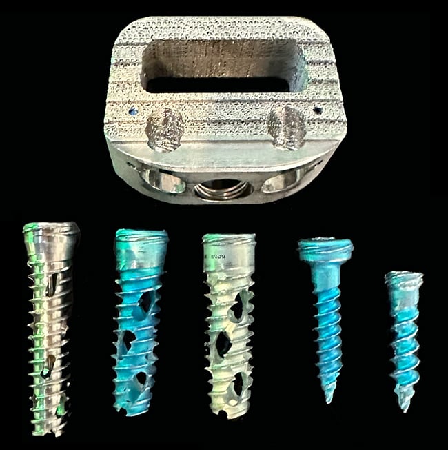 An interbody device ("cage") with fixation screws, used in ALIF surgery.
