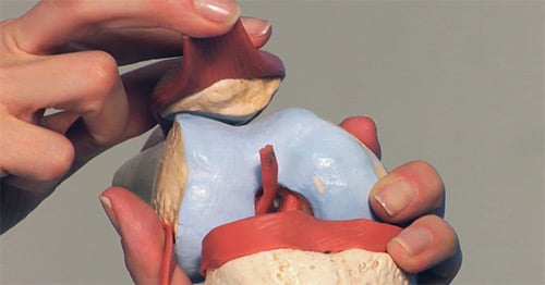 Dr. Shubin Stein holding a model of knee to demonstrate patellofemoral instability.