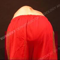 A man with scoliosis bending over.