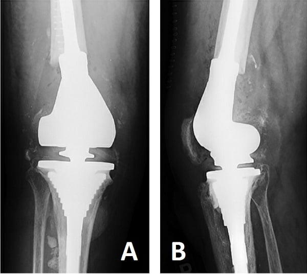 fig3