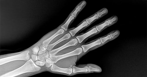 X-ray image of the hand and wrist.