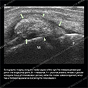 Ultrasound case 176 thumbnail