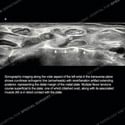 Ultrasound thumbnail image of case 187