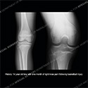 what's the diagnosis thumbnail case 206
