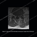 what's the diagnosis thumbnail case 212