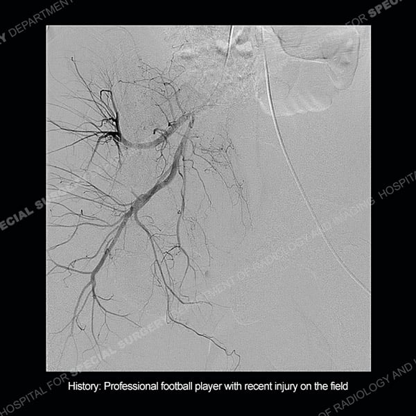 CT Radiographic image Case 221