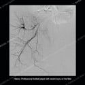 CT radiograph Case 221