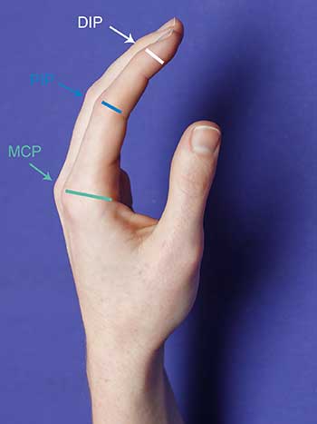 Photo of left hand side view, thumb side up notating DIP, PIP and MCP
