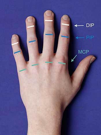 Photo of left hand top view notating DIP, PIP and MCP