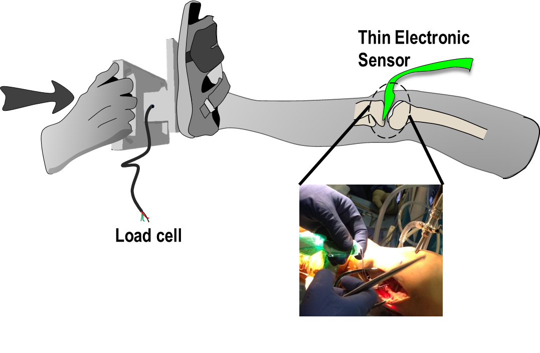 patient-based model