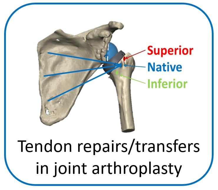 Shoulder research 1