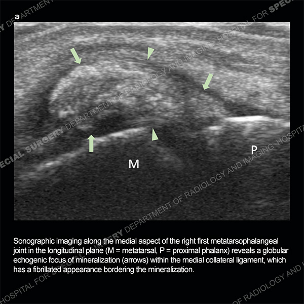 Ultrasound Case 169