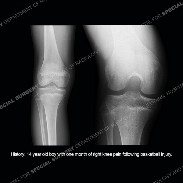 Diagnosis Case 206