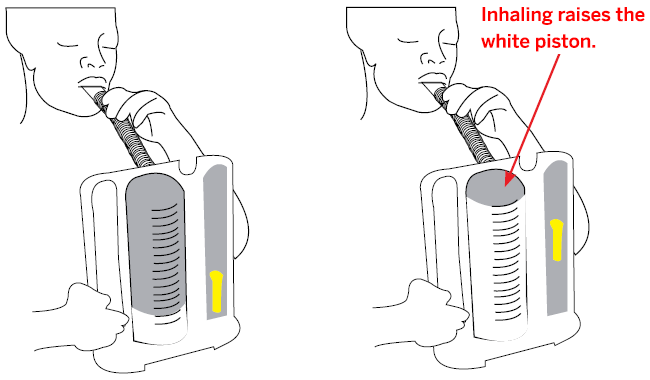 Illustration of a spirometer in use.