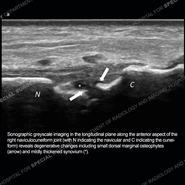Ultrasound Case 185