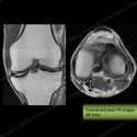 What's the Diagnosis? Case 22