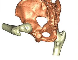 3D model created from CT scan images