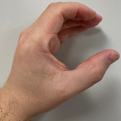 A hand stretching in a "C" shaped grasp position.
