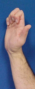 A hand in the hook fist position with the palm open, fingers bent down at the knuckles, and the thumb extending outward.