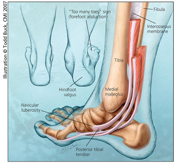 Illustration of an anatomical diagram of the foot and ankle