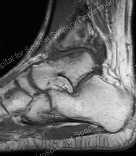 Image - neo-cartilage or new cartilage